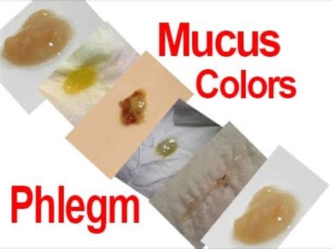 dilated mucus plug color chart|Phlegm Cheat Sheet: Recognizing Normal and。